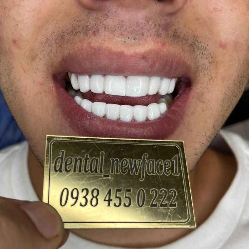 1692164329097.webp