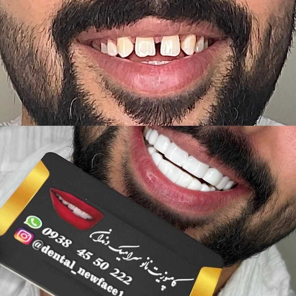 1693048914099.webp